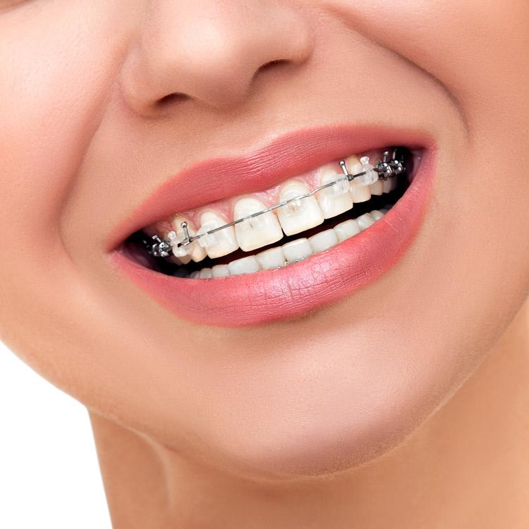 ReddyandHaverkos Orthodontics