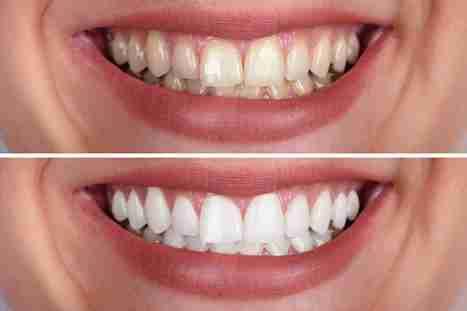 Image Source - Emergency Dentist Sheffield